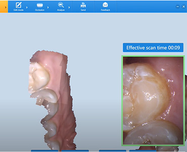 Scan strategiczny – Launca DL-206