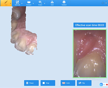 Skanowanie w 20 sekund – Launca DL-206