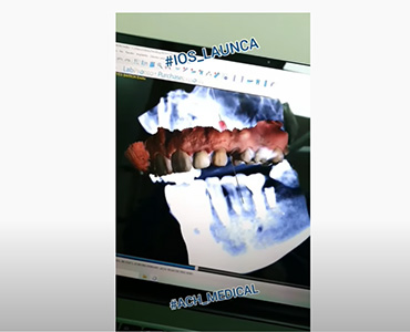 Studium przypadku – dr Jorge (Launca DL-206)